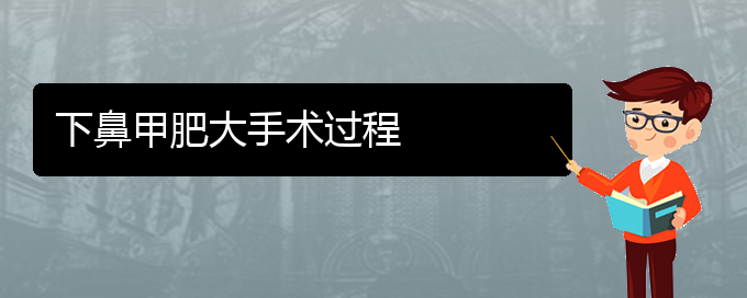 (貴陽鼻科醫(yī)院掛號(hào))下鼻甲肥大手術(shù)過程(圖1)