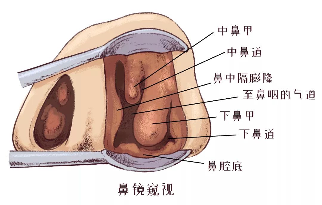 鼻甲肥大引起的呼吸困難怎么辦？(圖2)