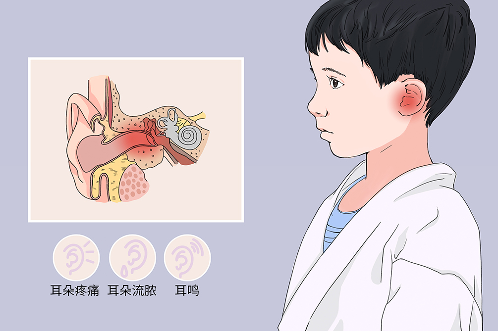 中耳炎雖小，但其危害不容小覷！(圖1)