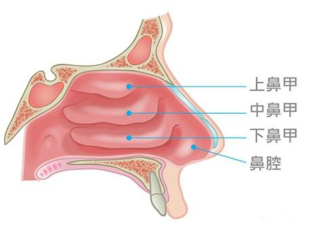 鼻甲肥大會(huì)引起面部結(jié)構(gòu)變化，還會(huì)導(dǎo)致眼袋、黑眼圈？(圖1)